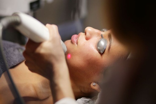 Laser Vein Removal